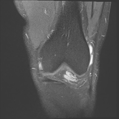 Figure 2 for case Orthovisc injections